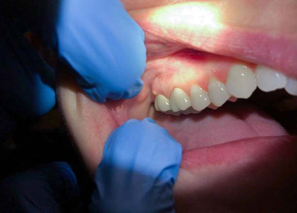 Best Walk-In Emergency Dentist in Bertram, TX